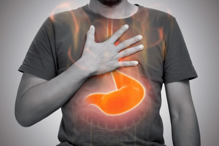 ADH_The-Link-Between-GERD-and-Weight-Gain